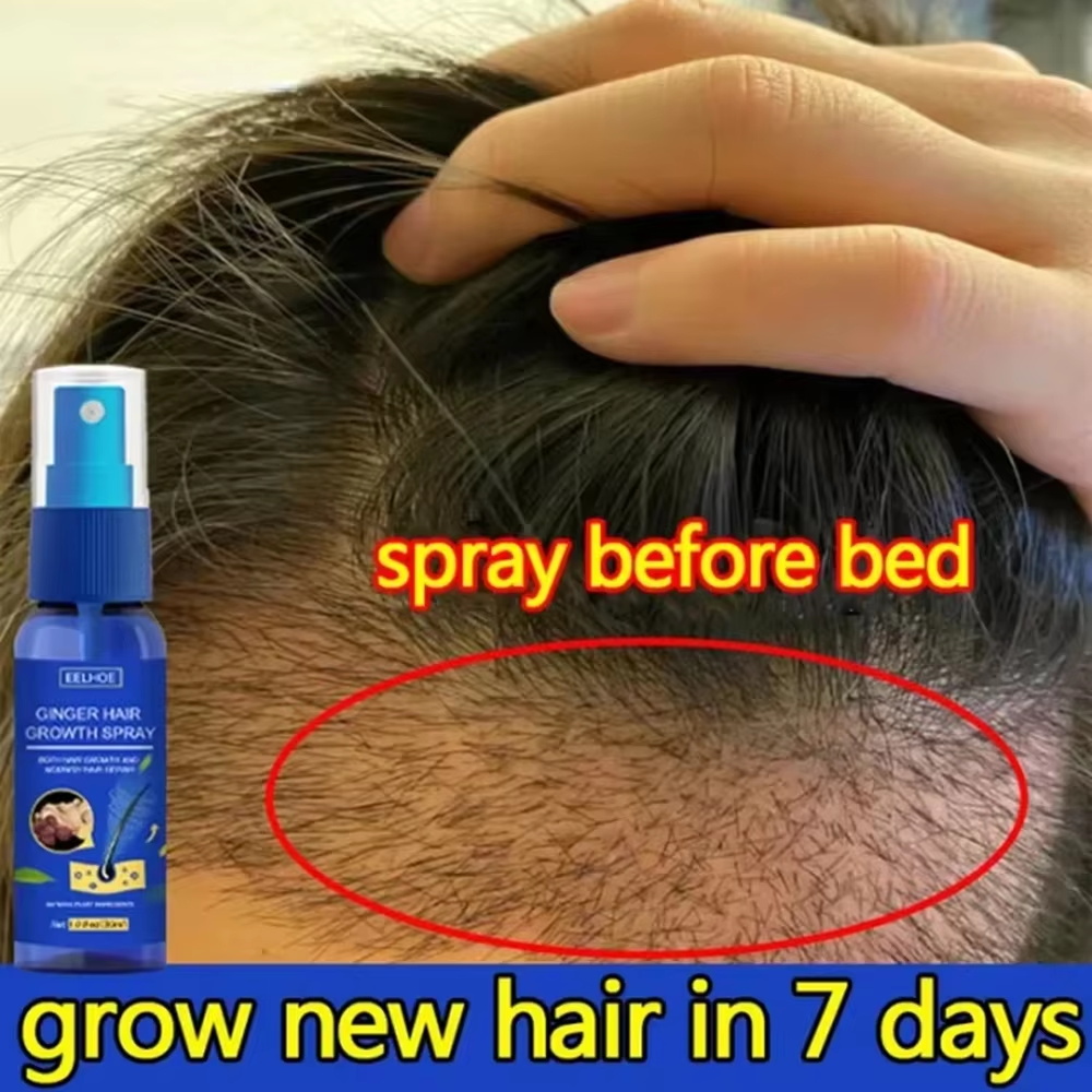 Hair Care Natural Products - Fast Ginger Hair Growth Spray Roots