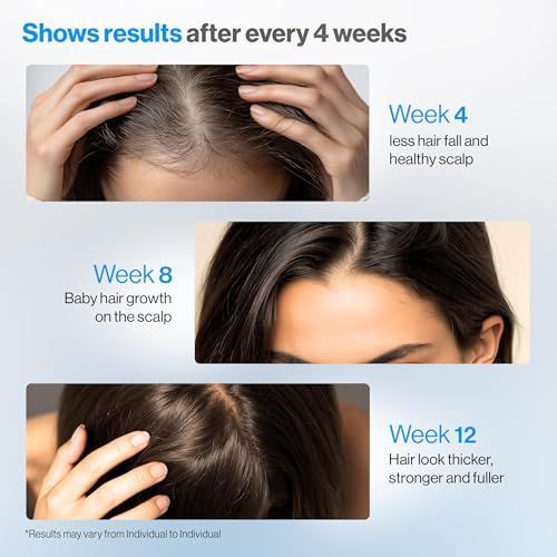 Premium Rosemary Anti-Hair Fal - Hair Care For Hair Fall ulasan dan harga