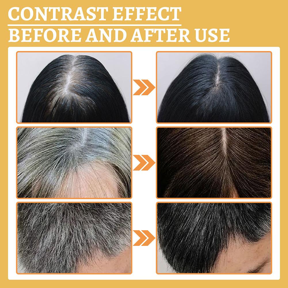 1/2PCS Hair Growth Serum Oil,  - Hair Care Natural Products ulasan dan harga