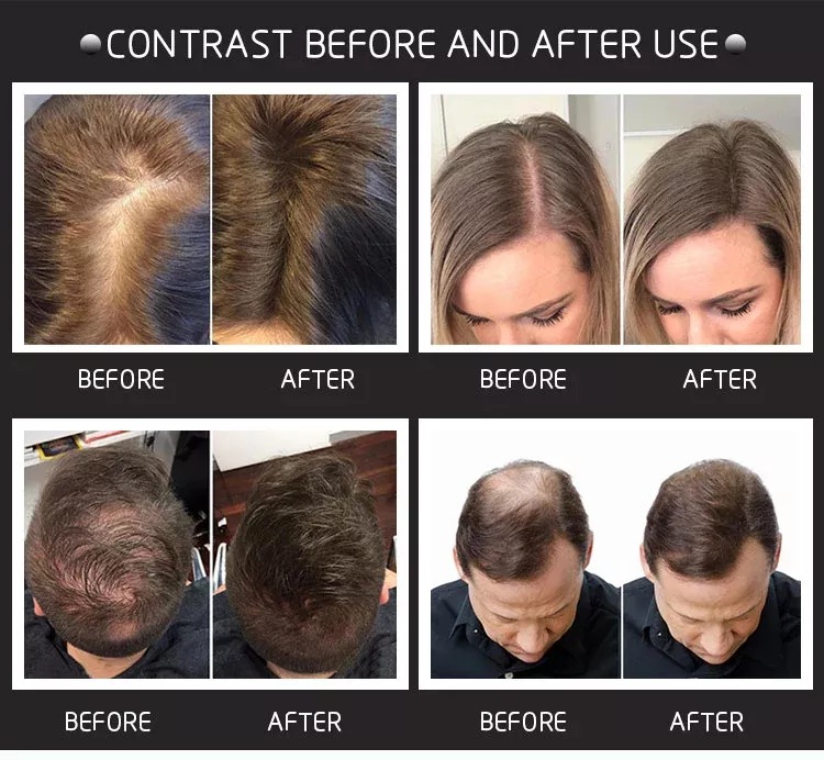 28g Hair Building Fibers Come  - Hair Care Natural Products ulasan dan harga