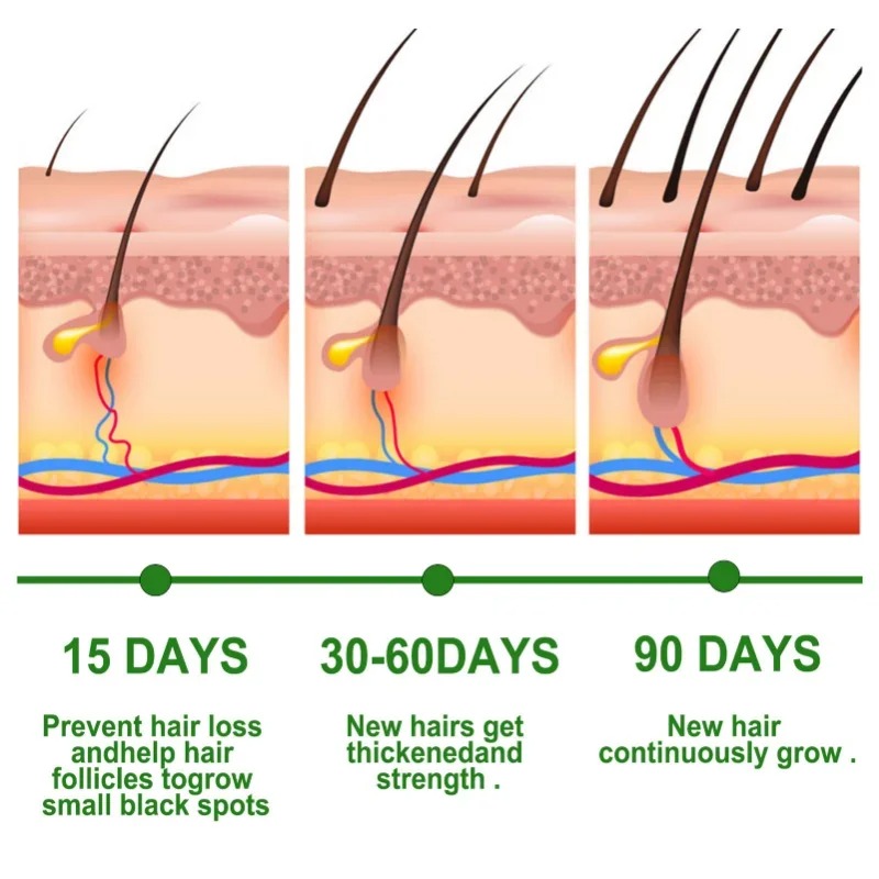 Hair Growth Serum Fast Growing - Hair Care Essence Oil ulasan dan harga