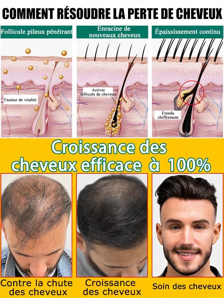 Anti Hair Loss Growth Serum, R - Hair Care For Hair Fall ulasan dan harga